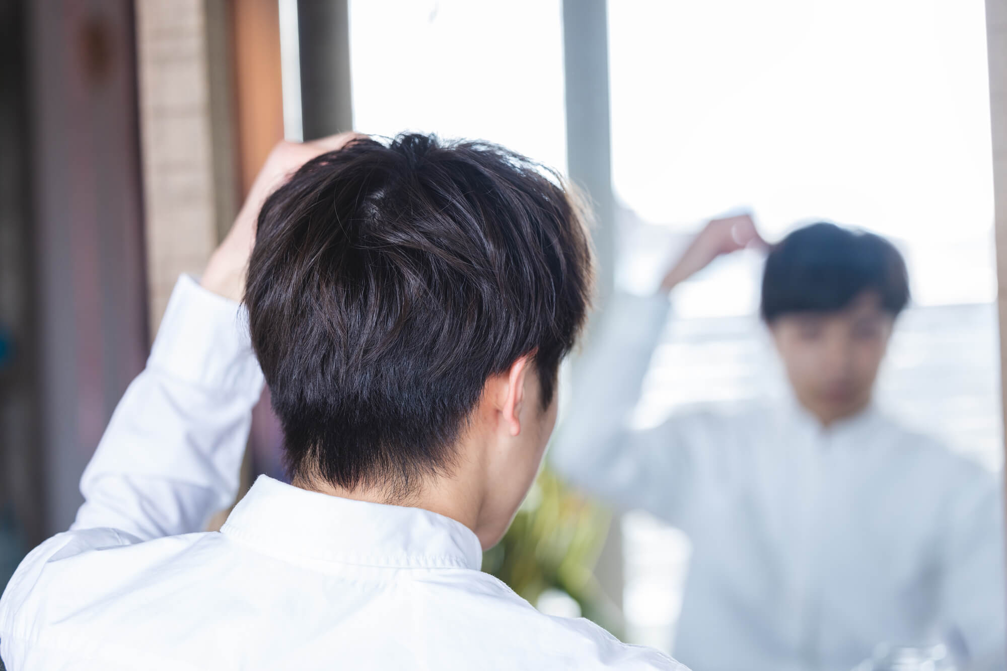 AGA（男性型脱毛症）の概要
